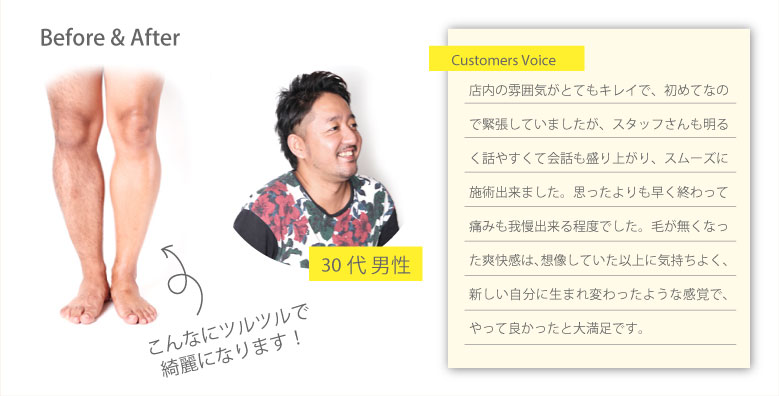 Before & After